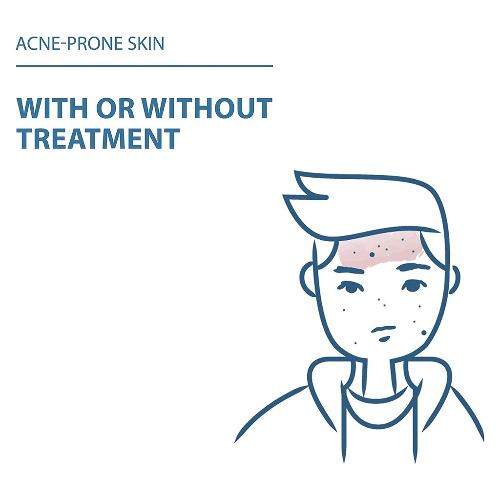 Ducray Keracnyl Foaming Gel 200 mL