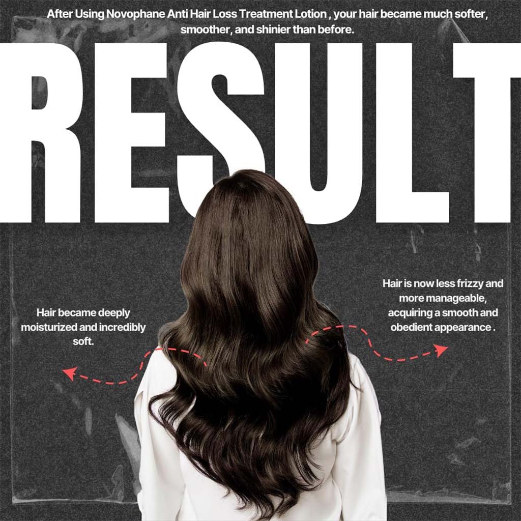 ACM Novophane Anti Hair Loss Lotion For Men & Women 100ml