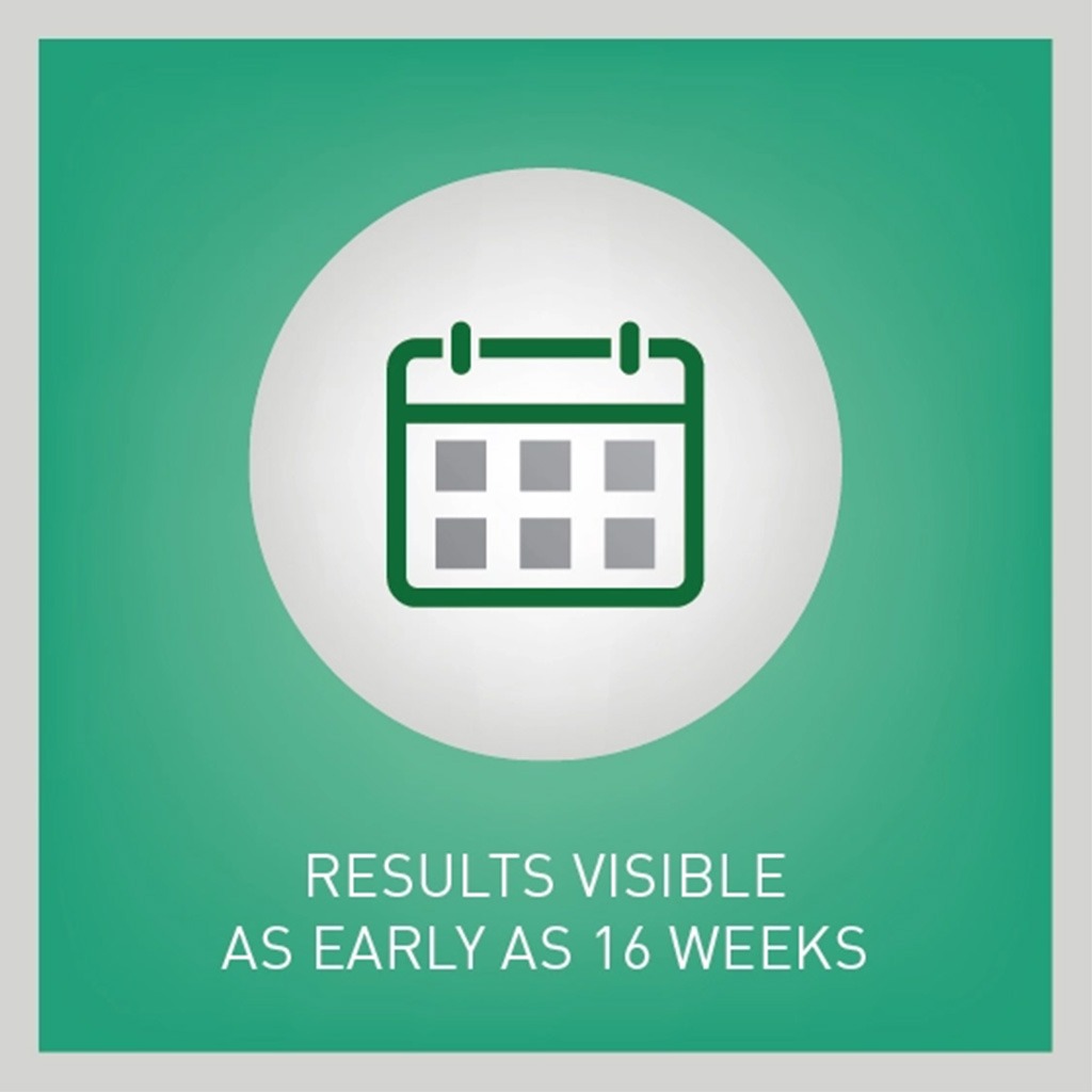 Regaine 2% For Men & Women Topical Hair Regrowth Solution 60ml