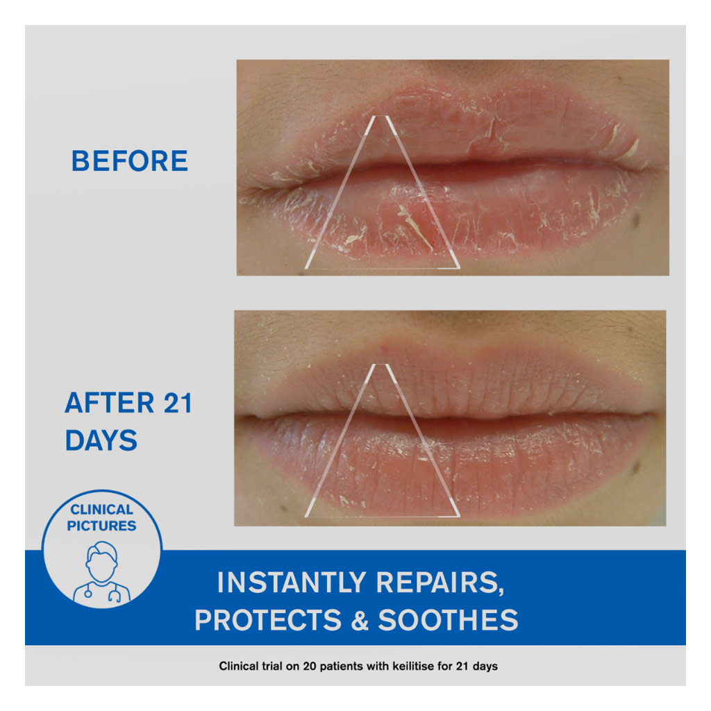 Uriage Bariederm-CICA Protecting Lip Balm For Soothing & Repairing 15ml