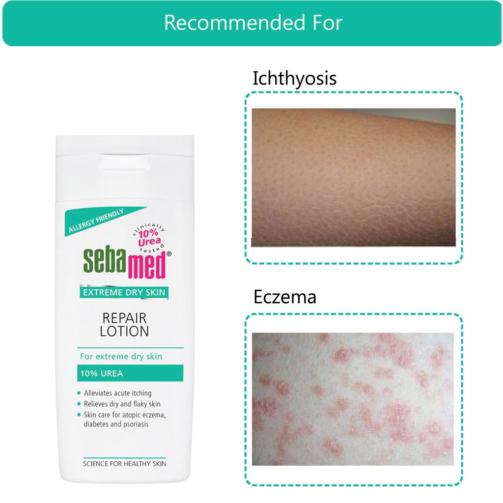 Sebamed Extreme Dry Urea Lotion 200 mL