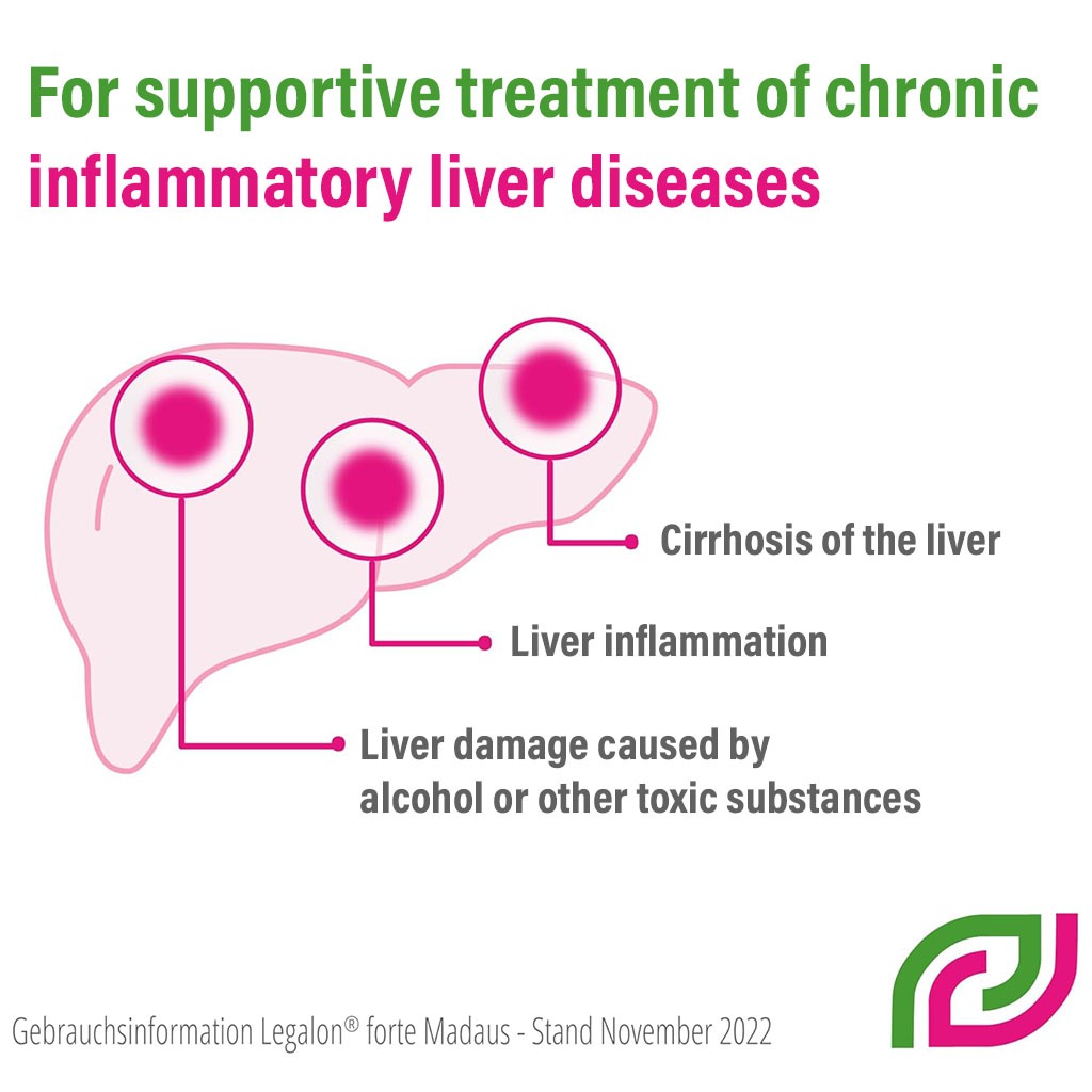 Legalon Forte 140 mg Capsules 100's