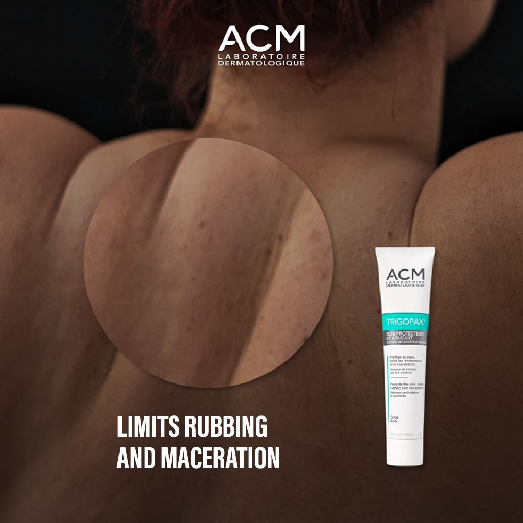 ACM Trigopax Cream 75 g