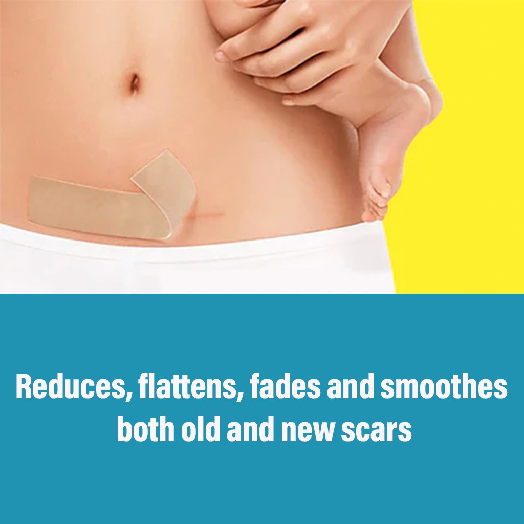 NewGel+ Advanced Medical-Grade 2" x 8" C-Section Strip For C-Section Scar Management, NG-160 Beige, Pack of 1's 