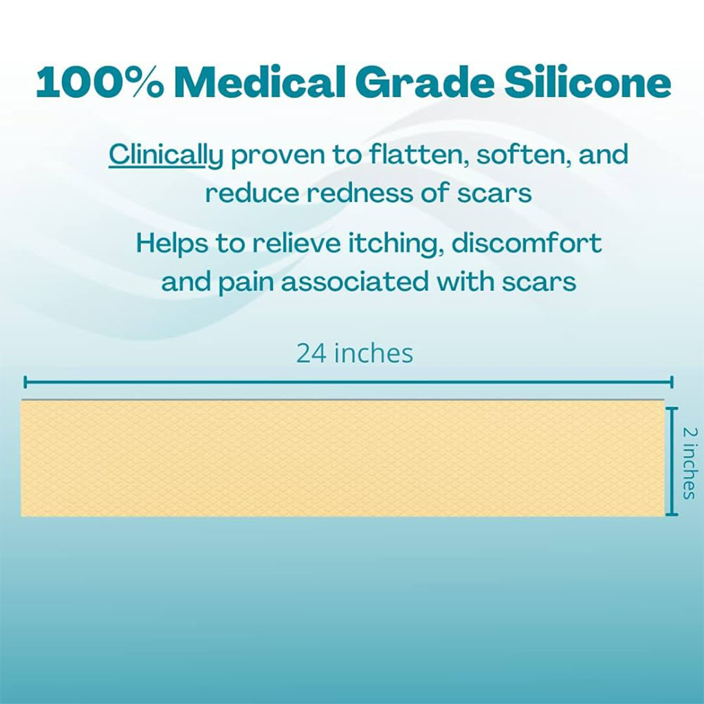 NewGel+ 24" x 2" Abdomen/Extremity Silicone Strip, Beige NG-164, Pack of 1's