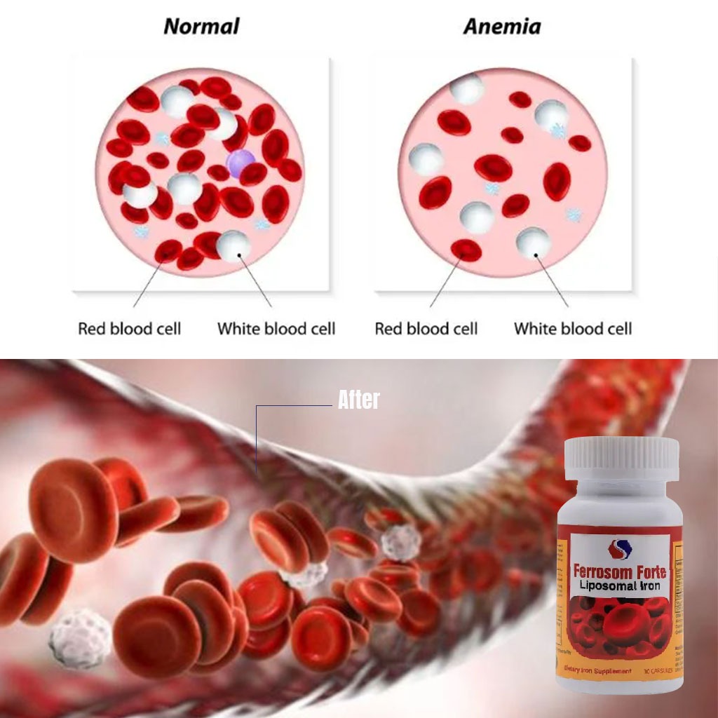 Ferrosom Forte Liposomal Iron Capsule 30's