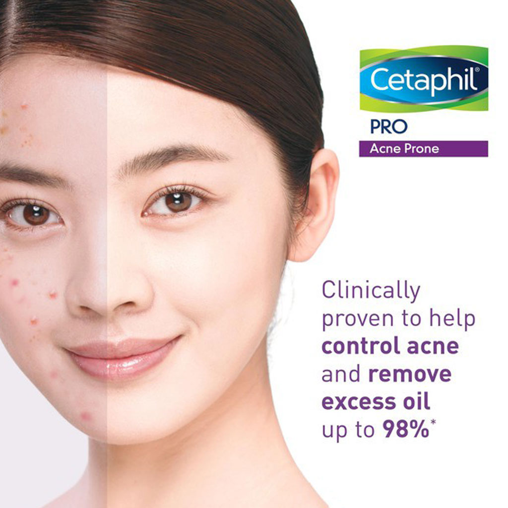 Cetaphil PRO Acne-Prone Skin Foam Wash 235 mL