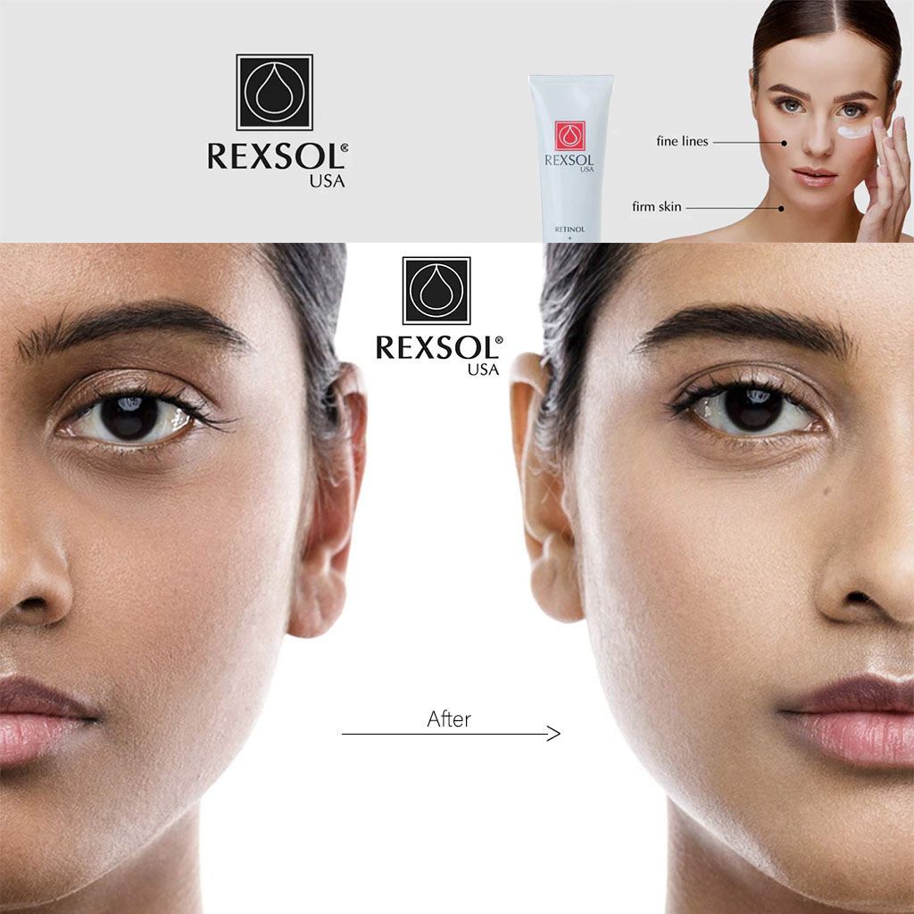 Rexsol Ultra Whitening Cream 56 g