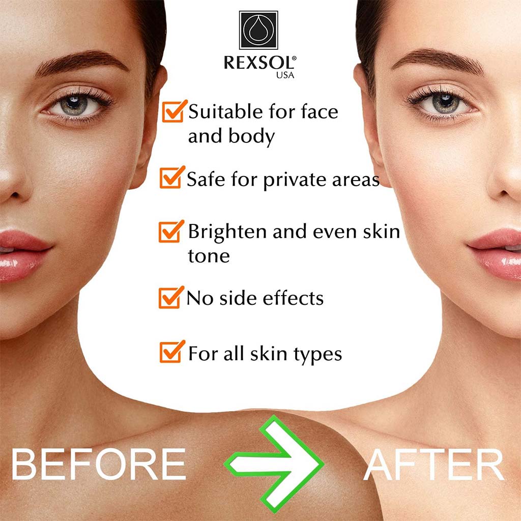 Rexsol Ultra Whitening Cream 56 g