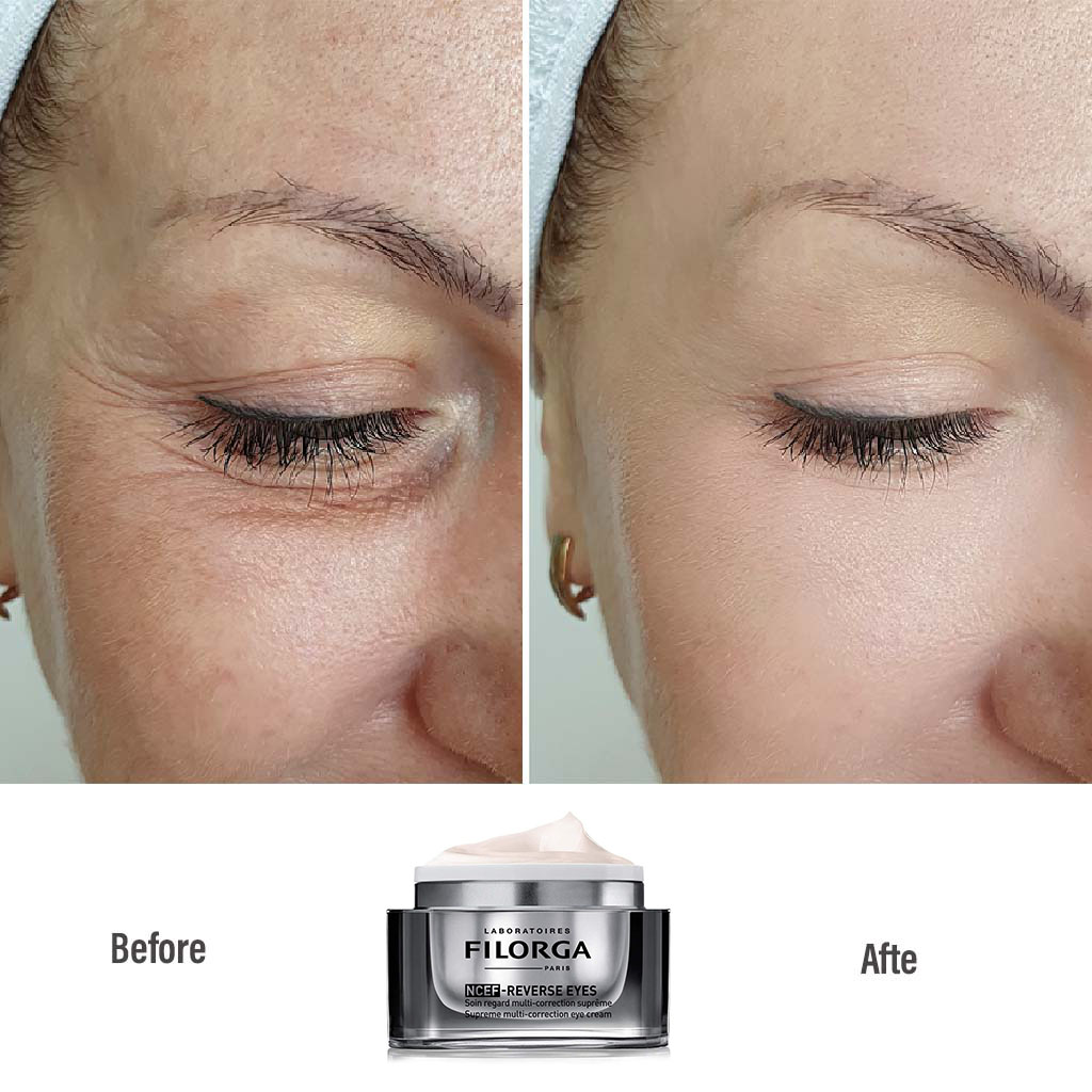 Filorga NCEF Reverse Eyes Cream 15 mL