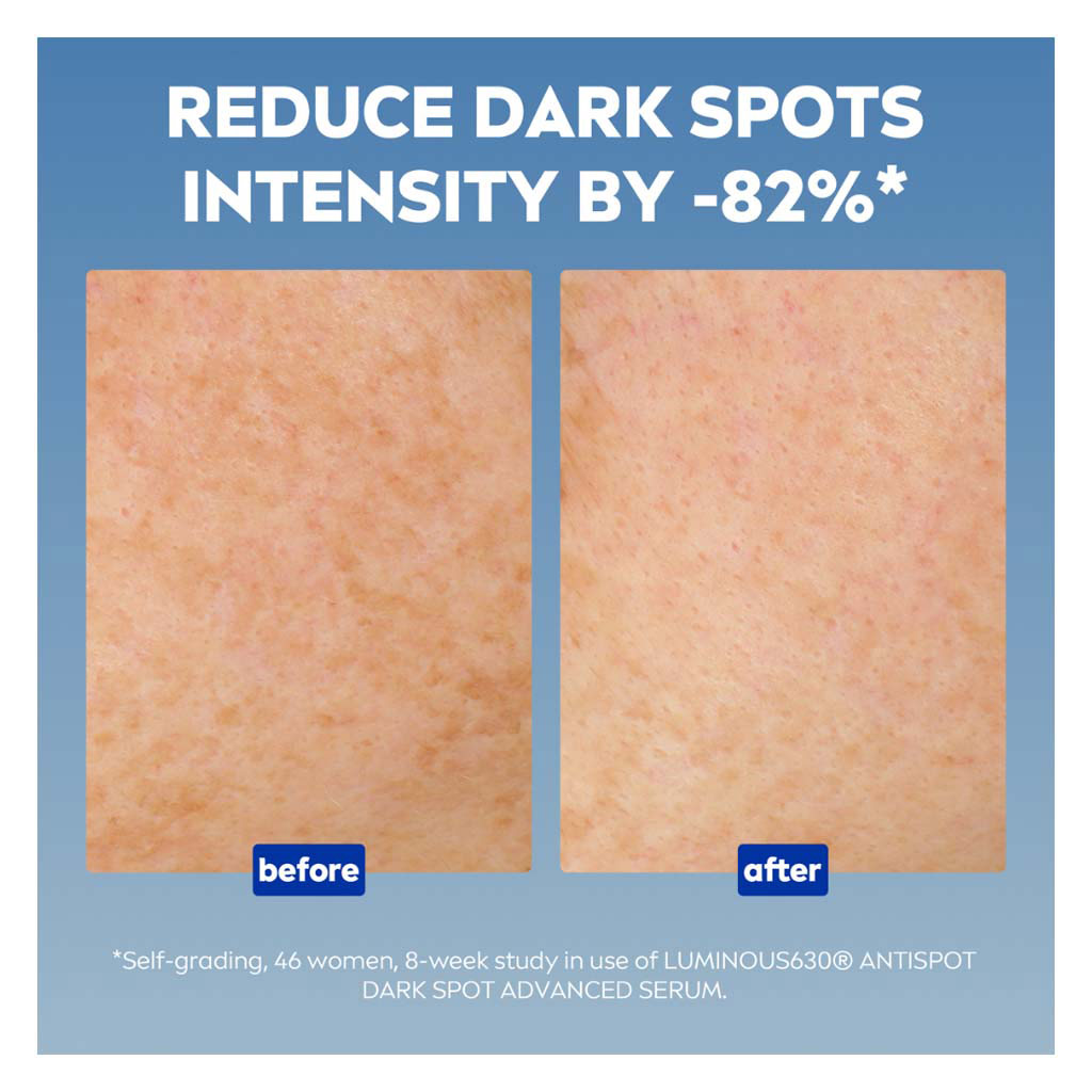 Nivea Luminous630 Even Glow Concentrated Serum For Dark Spots 30ml