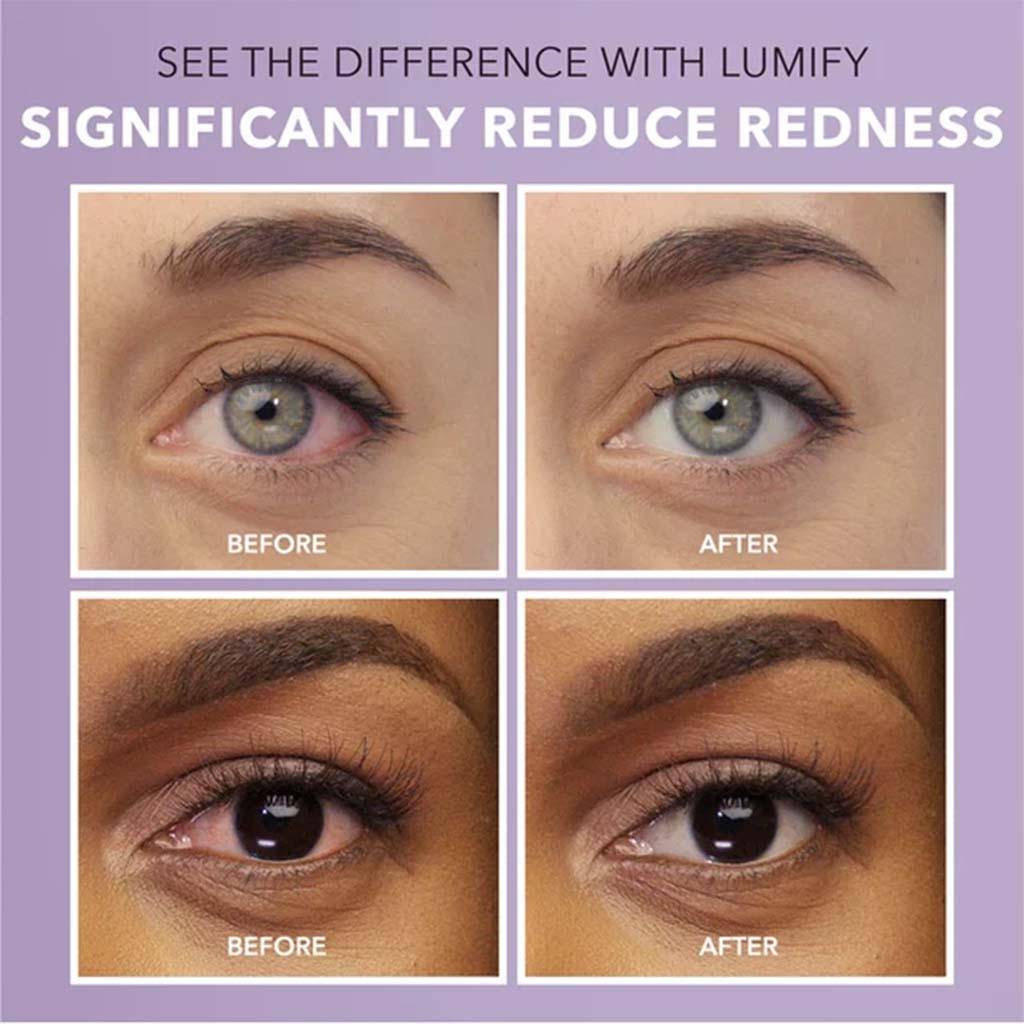 Lumify® 0.025% Eye Drops 7.5 mL