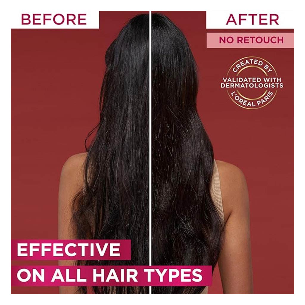 Loreal Elvive Fall Resist Oil Replacement Cream 300ml