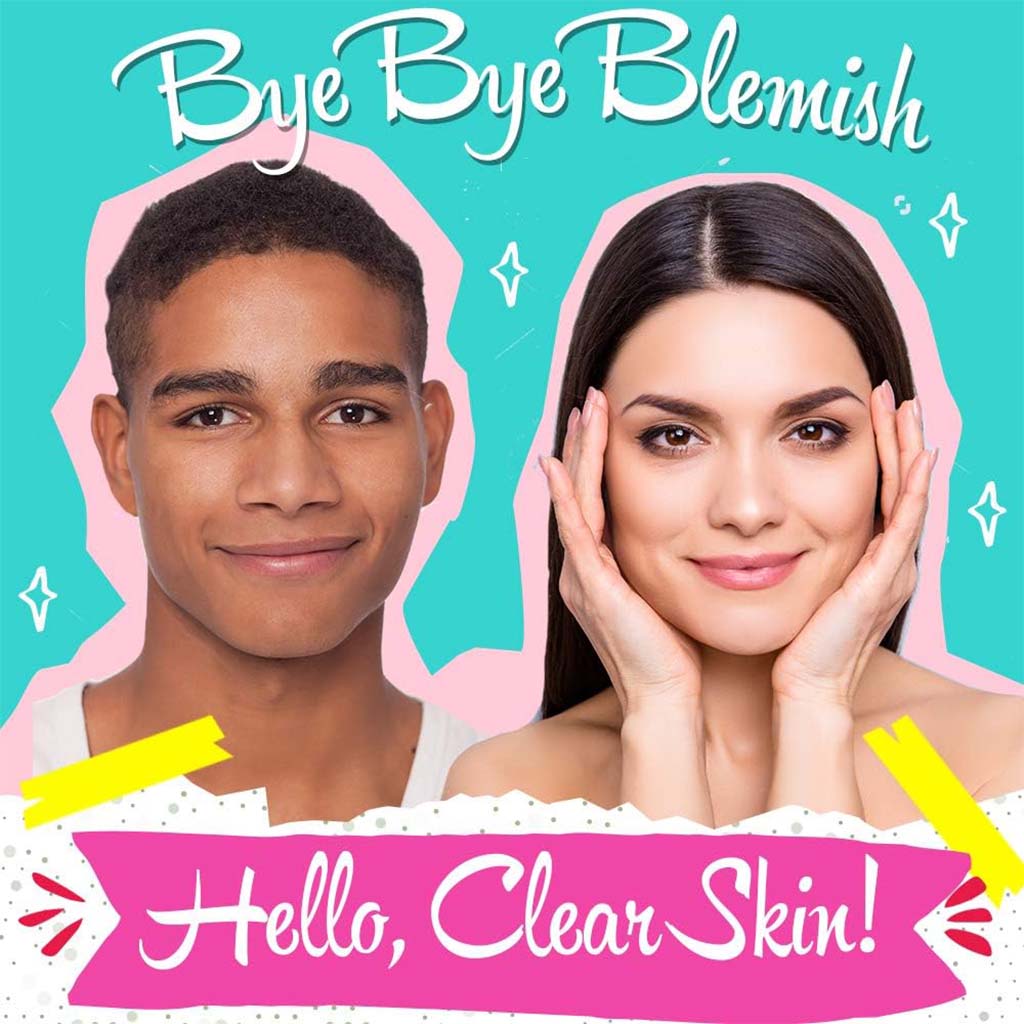 Bye Bye Blemish For Acne Drying Lotion 30 mL