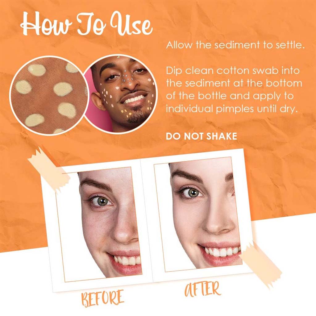 Bye Bye Blemish Vitamin C Dark Spot Brightening Lotion 30 mL