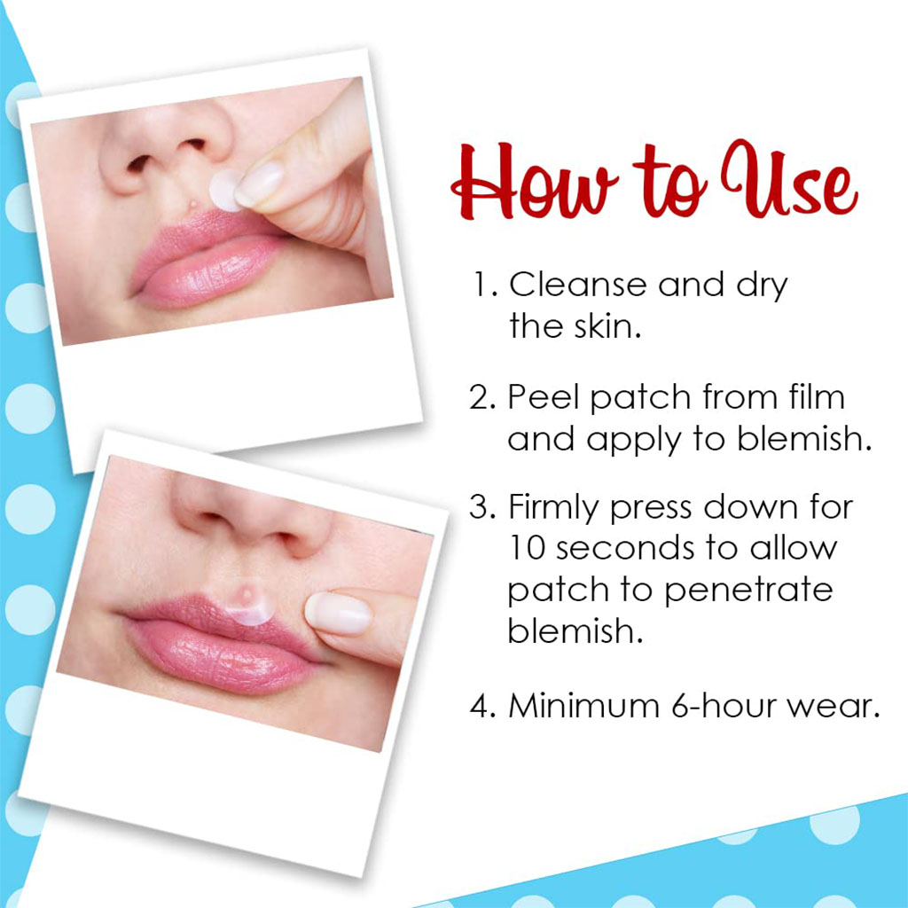 Bye Bye Blemish Microneedling Blemish Patches 9's