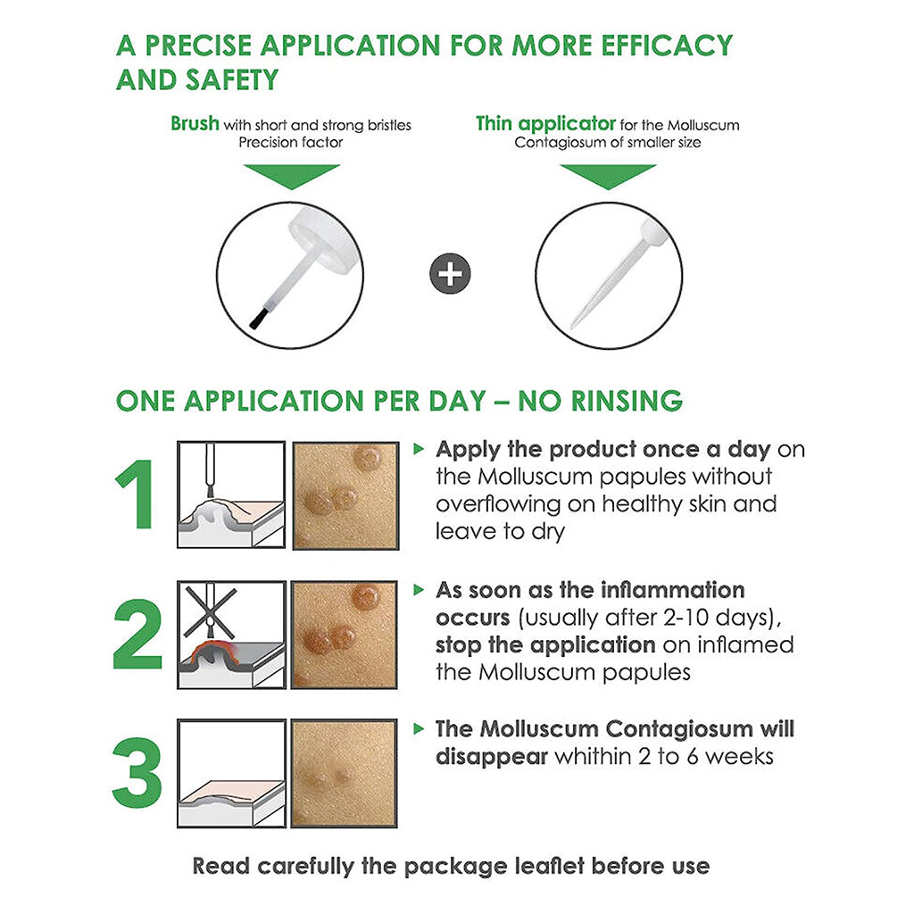 ACM Molutrex 5% Potassium Hydroxide Topical Solution For Molluscum Contagiosum 3ml