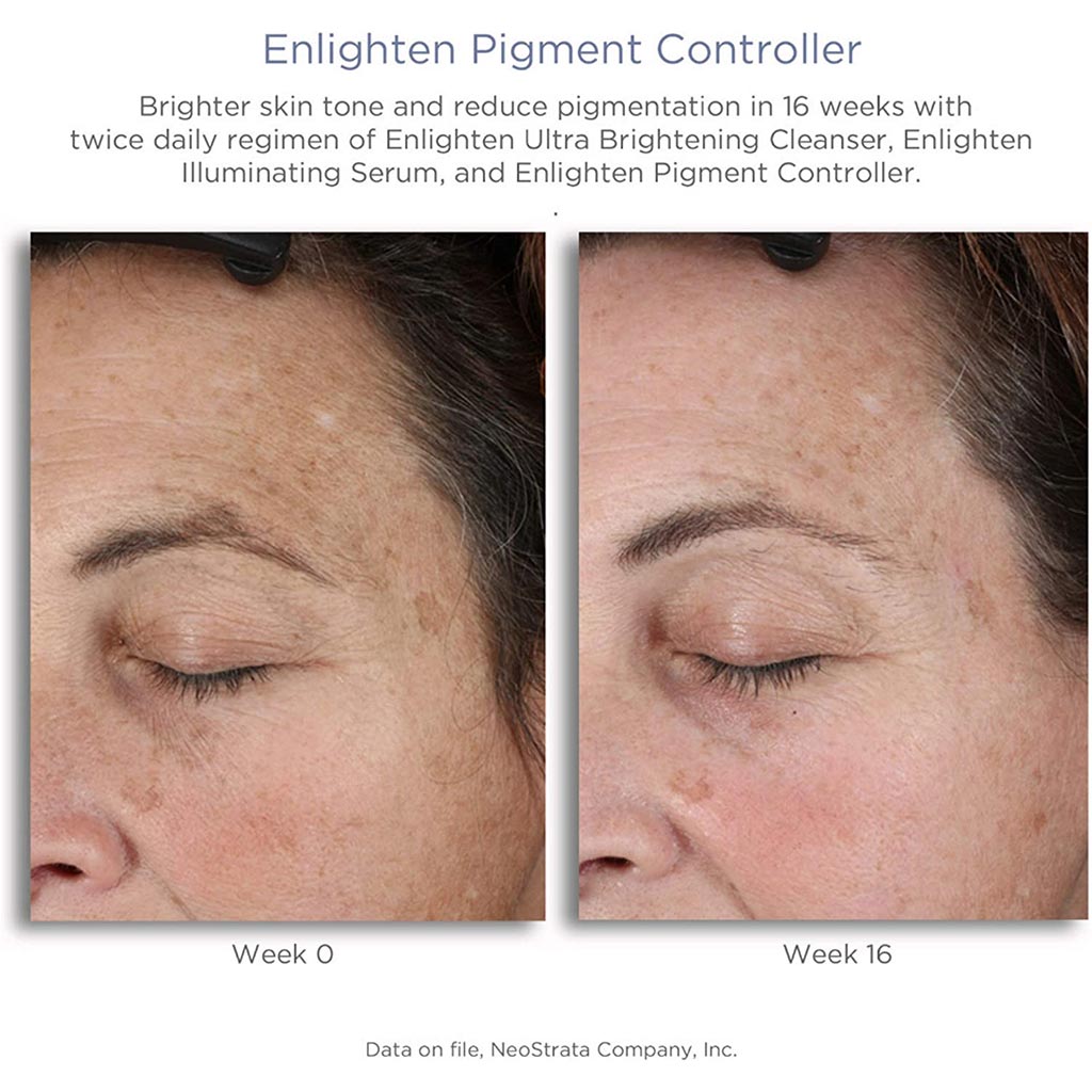 Neostrata Enlighten Pigment Controller Fluid For Dark spots and Uneven skin tone 50ml