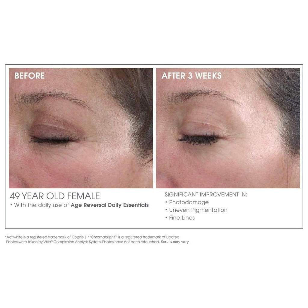 GlowBiotics Probiotics Advanced Retinol Renewal Anti-Aging Treatment For Face And Neck 30ml