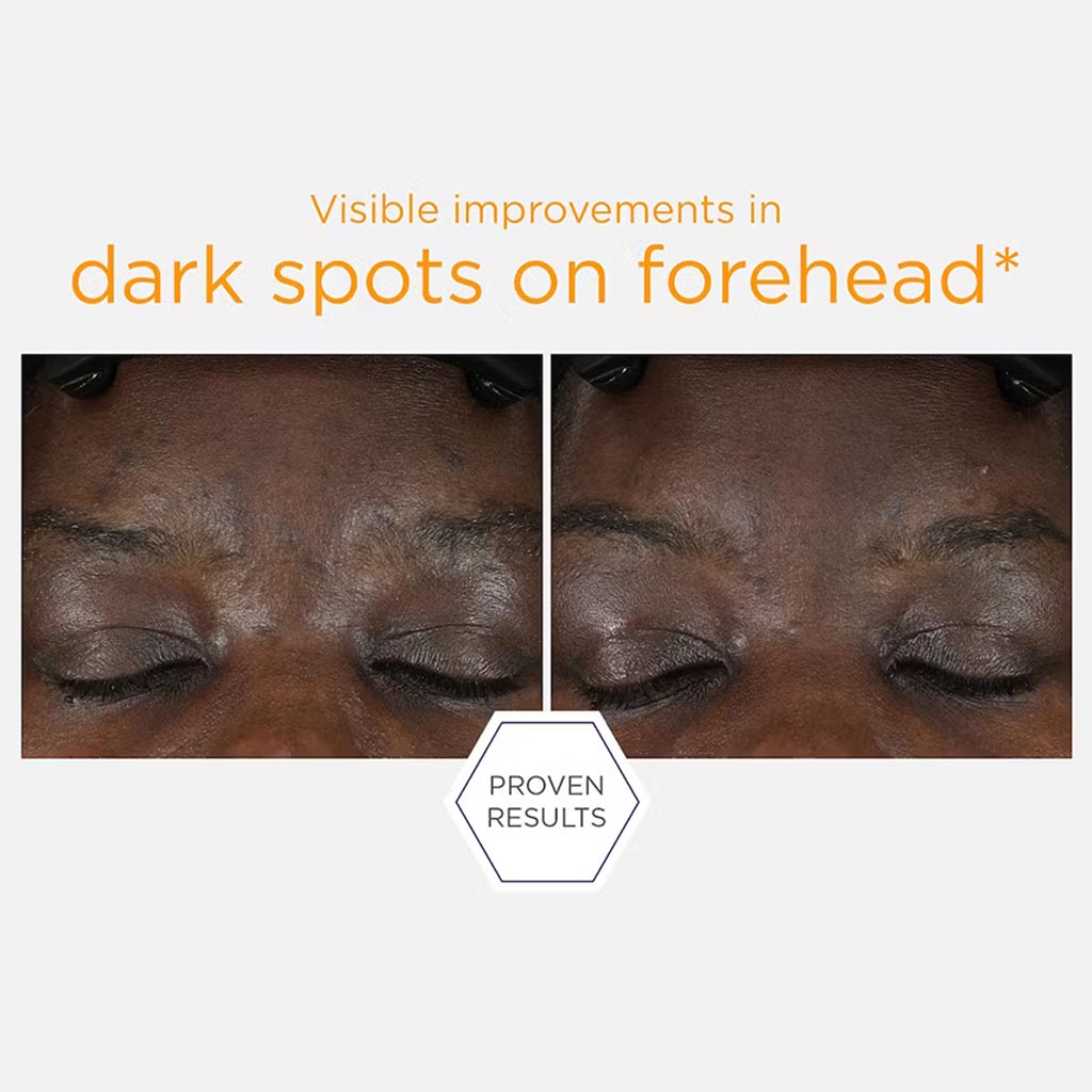 Neostrata Enlighten 15% Vitamin C + PHA Brightening Facial Serum 15ml