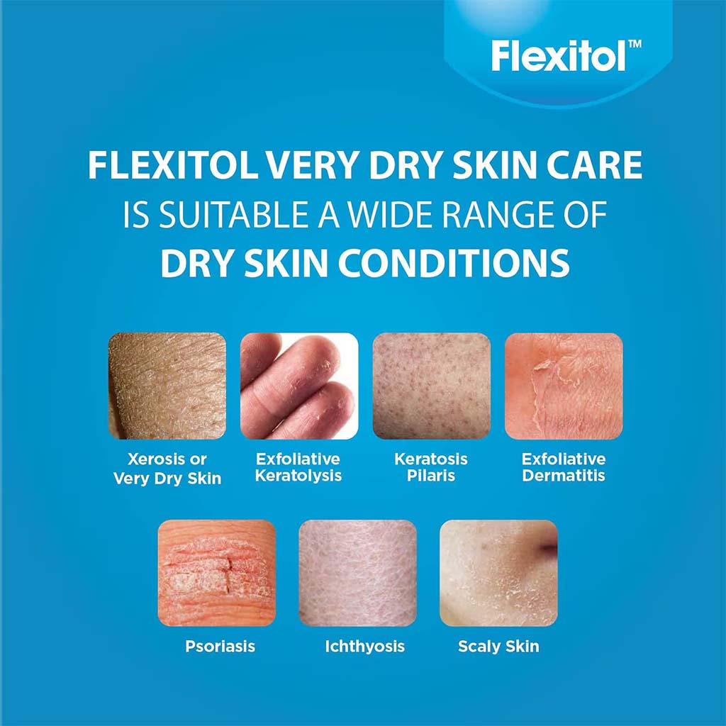 Flexitol Very Dry Skin Lotion For Very Dry Itchy Skin Relief 500ml