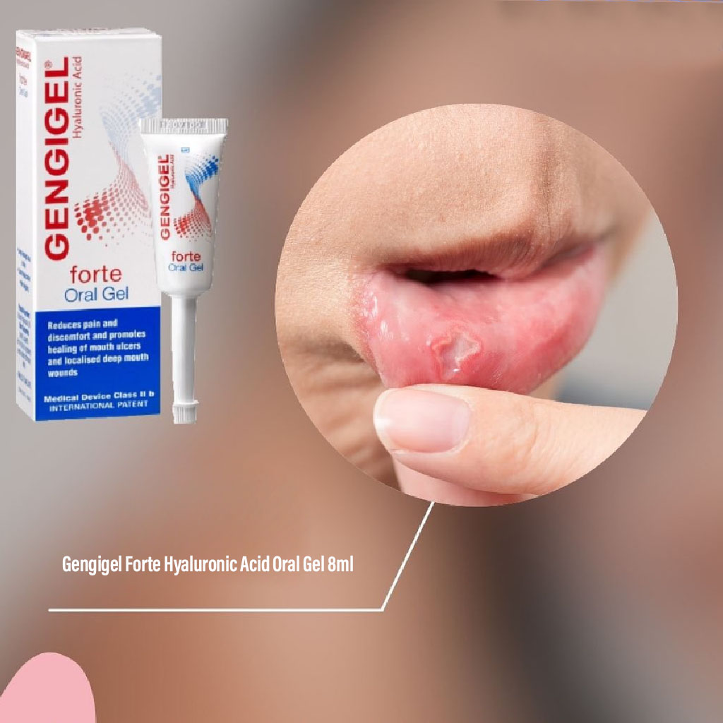 Gengigel Forte Hyaluronic Acid Oral Gel, Pain Relieving Oral Gel For Mouth Ulcers & Mouth Wounds 8ml