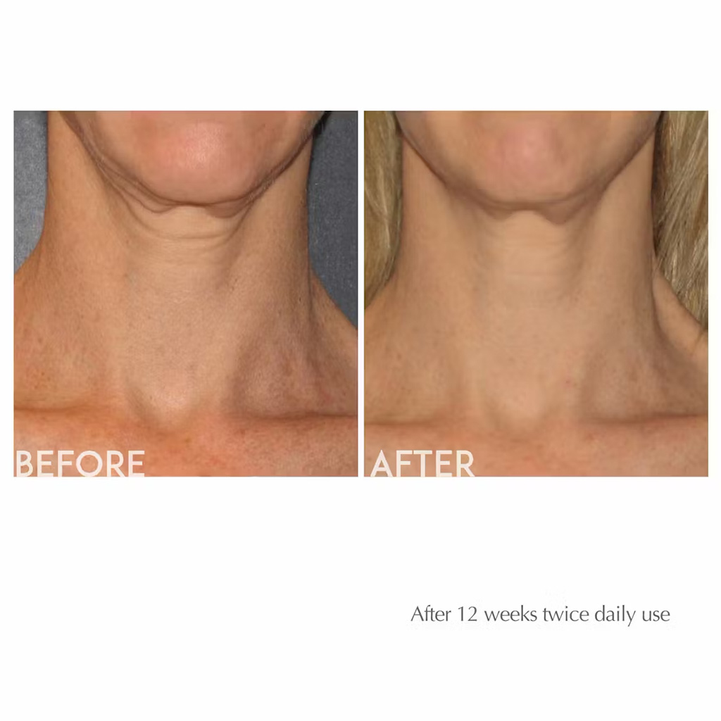 Exuviance Age Reverse Anti-Aging Toning Neck Cream 125g