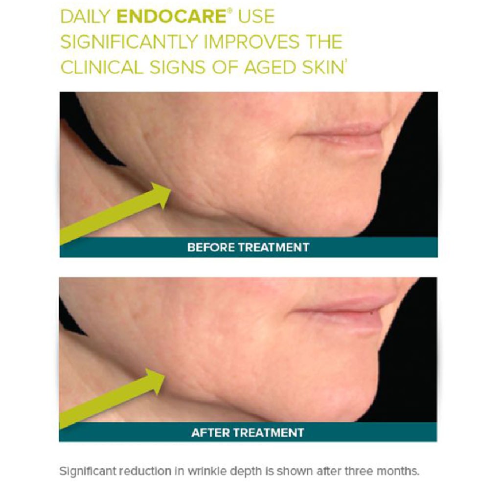 Endocare Regenerating Anti-Aging Intensive Formulation Ampoules For All Skin Types 7X1ml