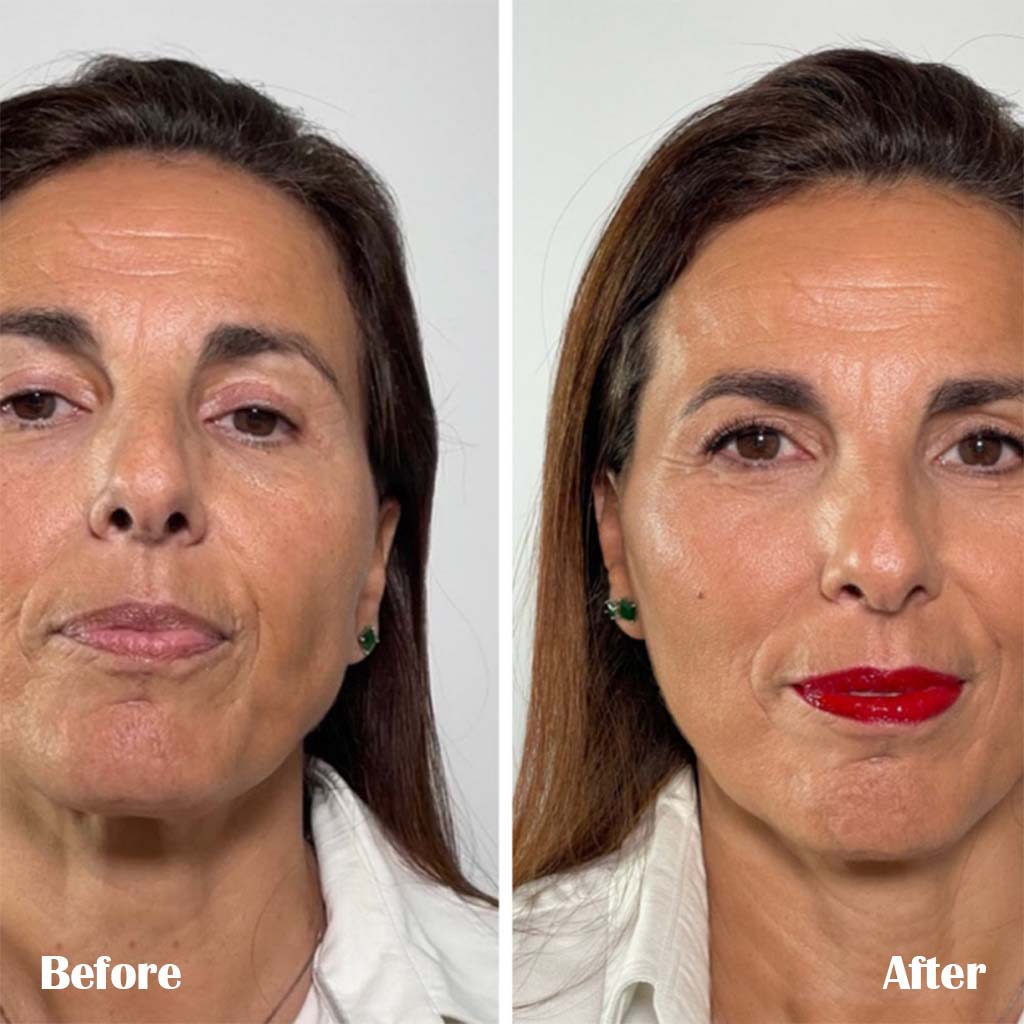 LaCabine Flash Effect Instant Lifting & Anti-Fatigue 2ml Facial Ampoules For All Skin Types, Pack of 10's