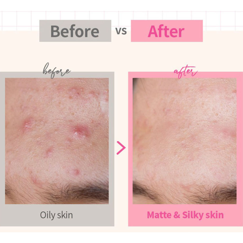 K-Secret Calamine Secret Bar For Sensitive Skin 100g