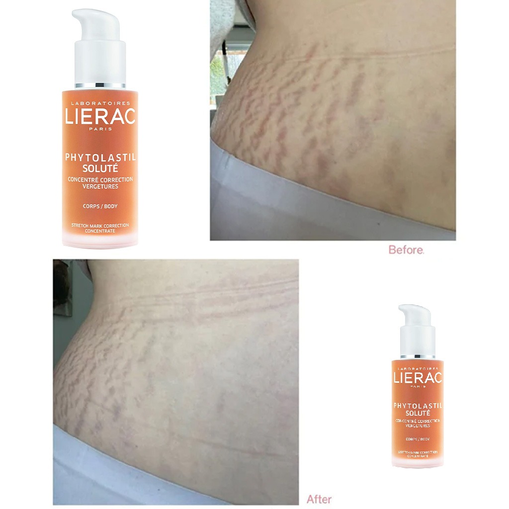 Lierac Phytolastil Solute Stretch Mark Correction Concentrate 75ml
