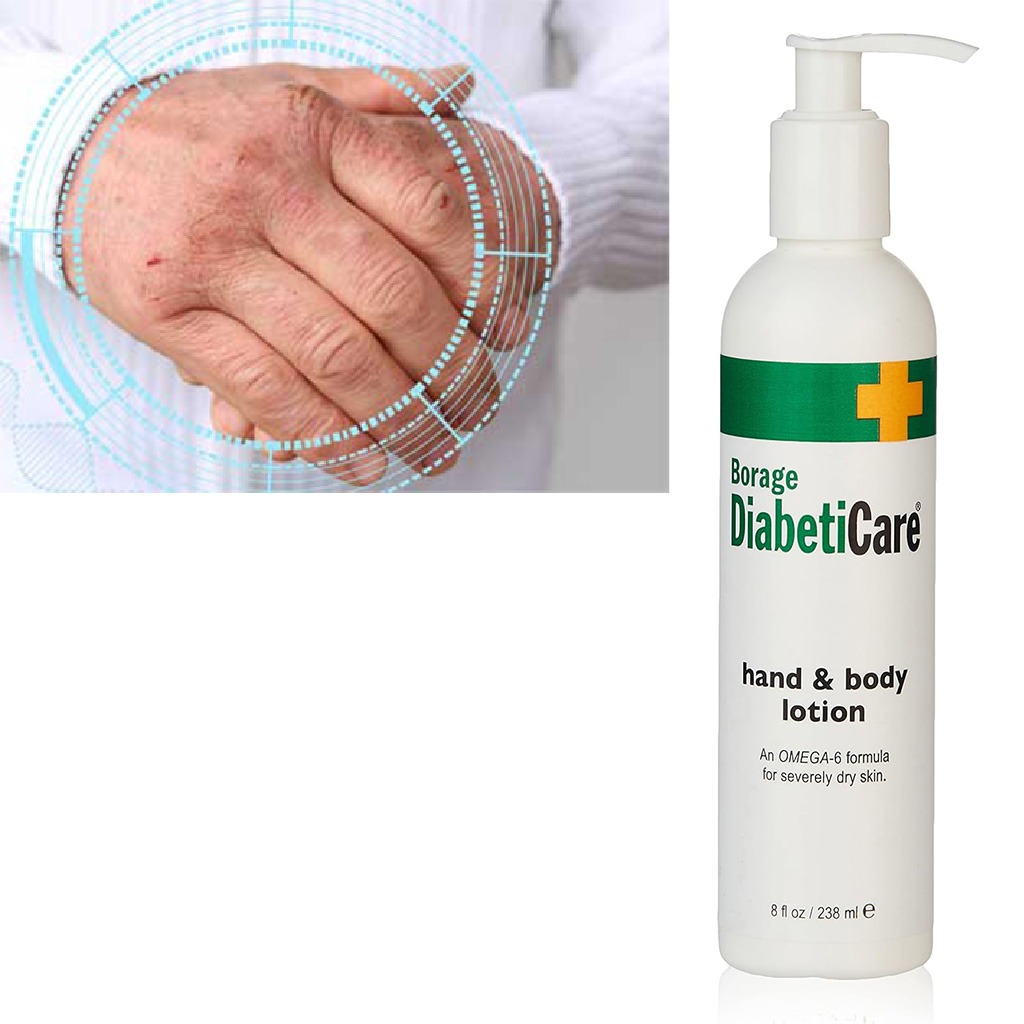 ShiKai Borage DiabetiCare Omega-6 Hand & Body Lotion For Dry Skin 238ml