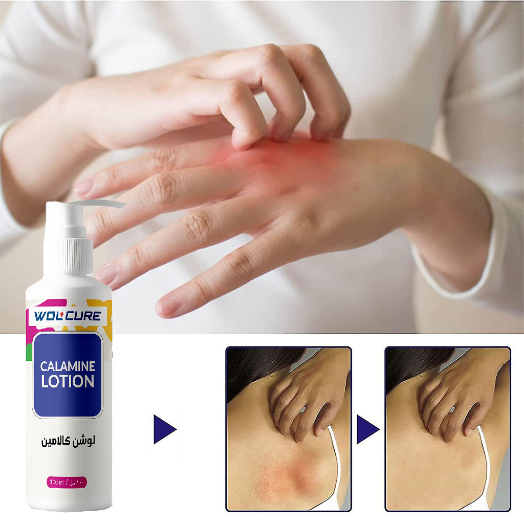 Wolcure Calamine Lotion 100ml