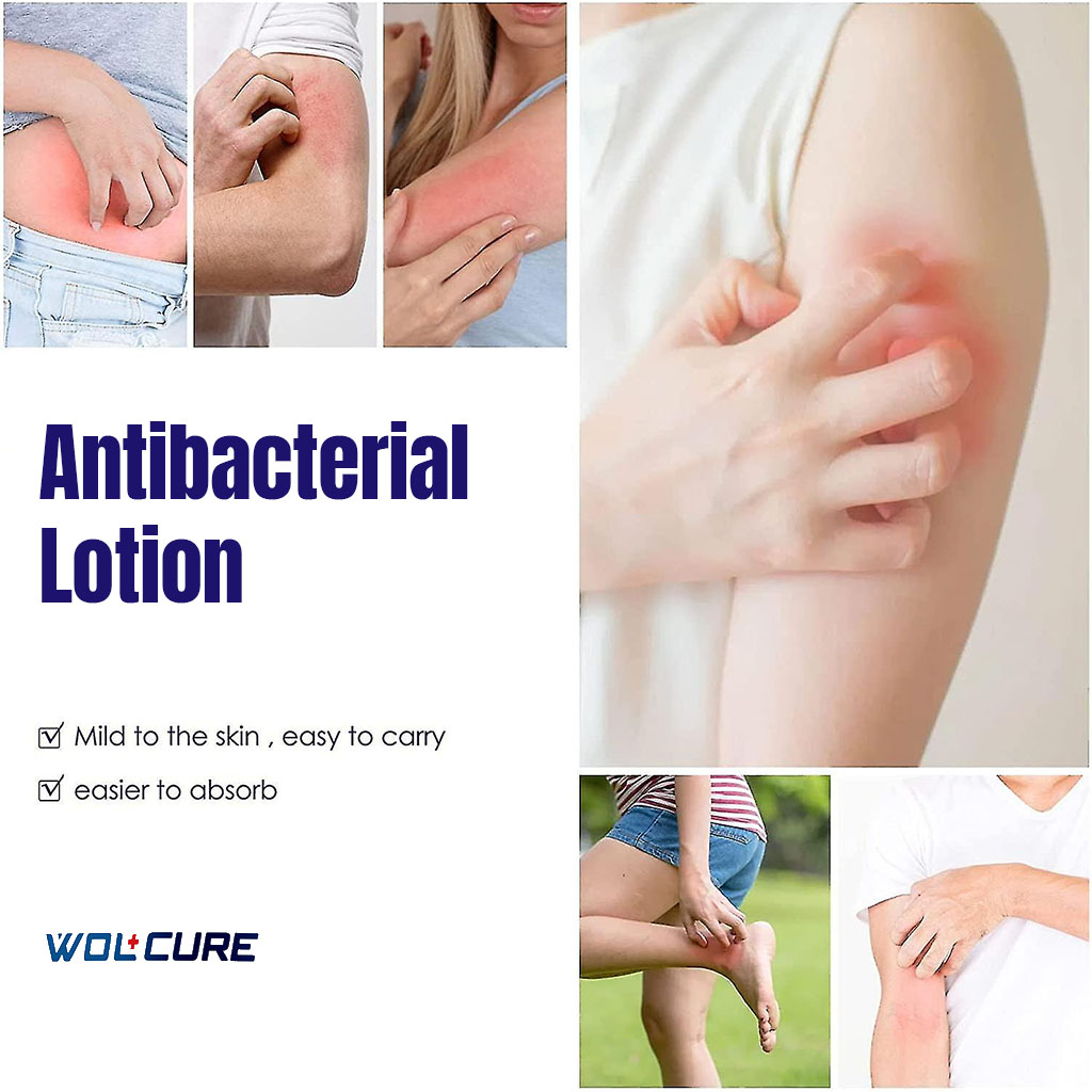 Wolcure Calamine Lotion 100ml