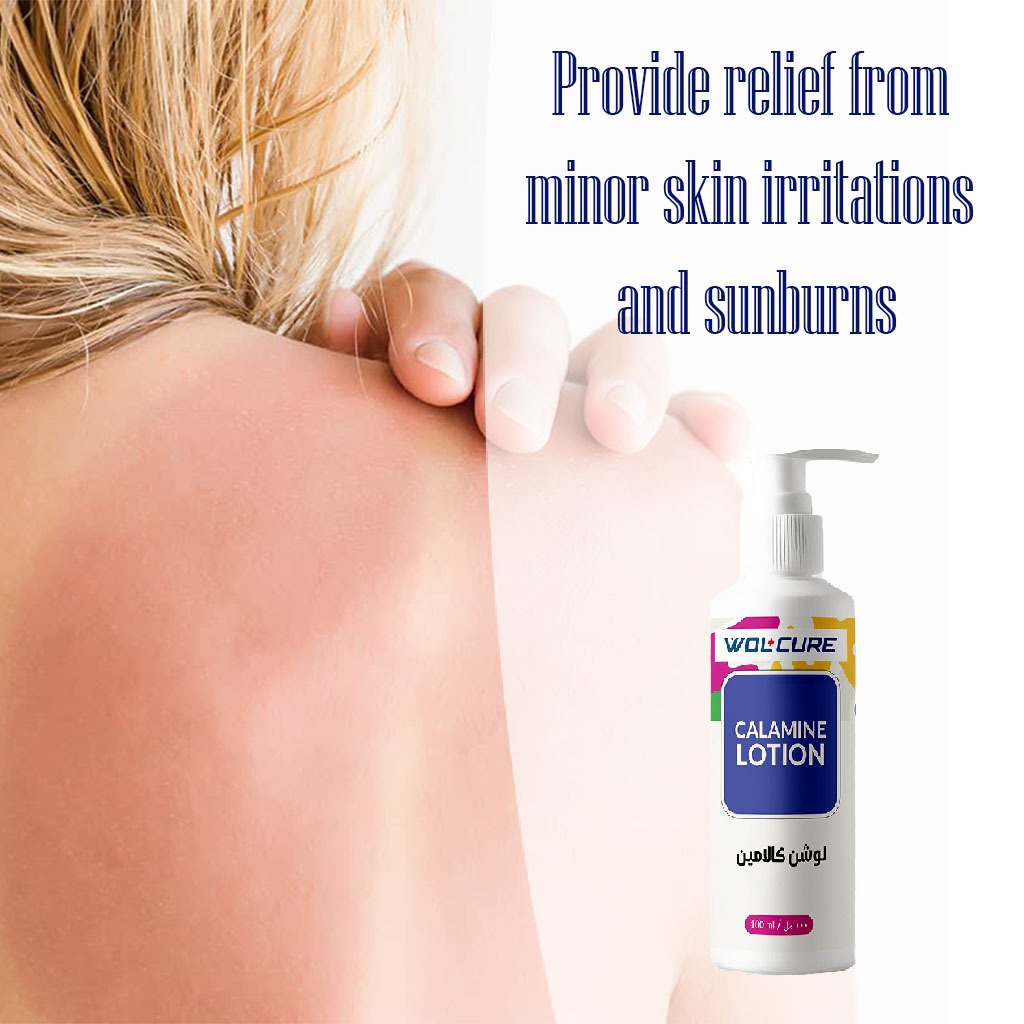 Wolcure Calamine Lotion 100ml