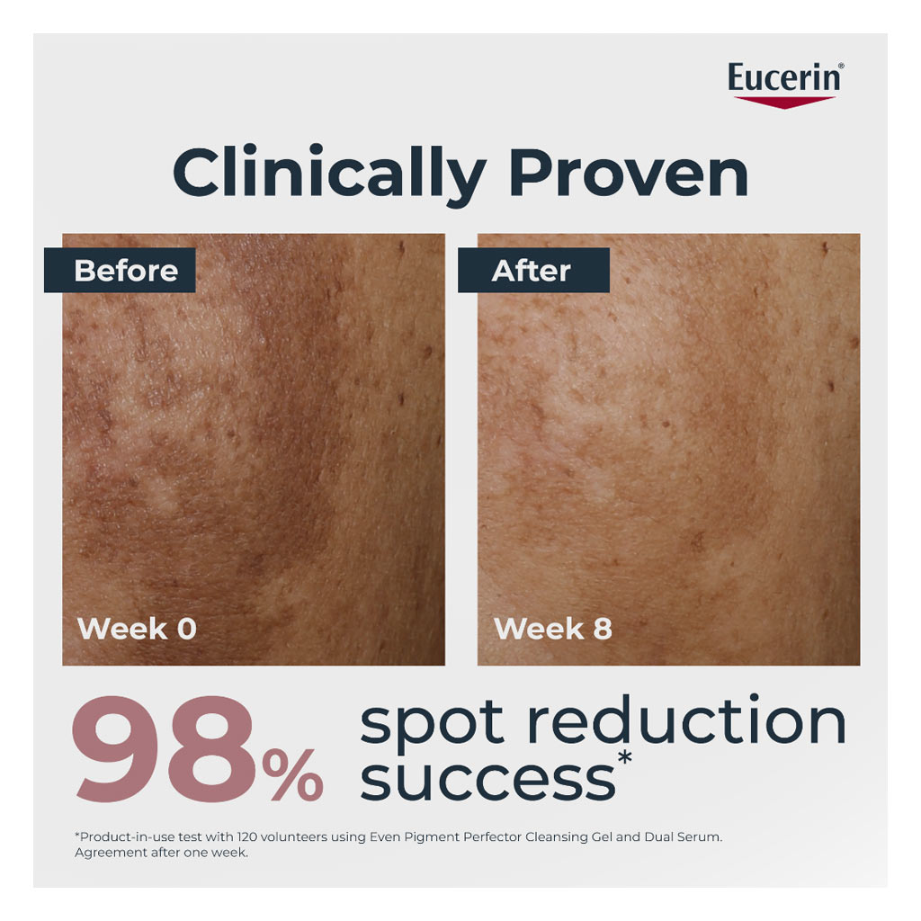 Eucerin Even Pigment Perfector Dual Hyperpigmentation Serum 30ml + Eucerin Sun Pigment Control Sunscreen SPF50+ Sun Fluid 50ml - PROMO PACK
