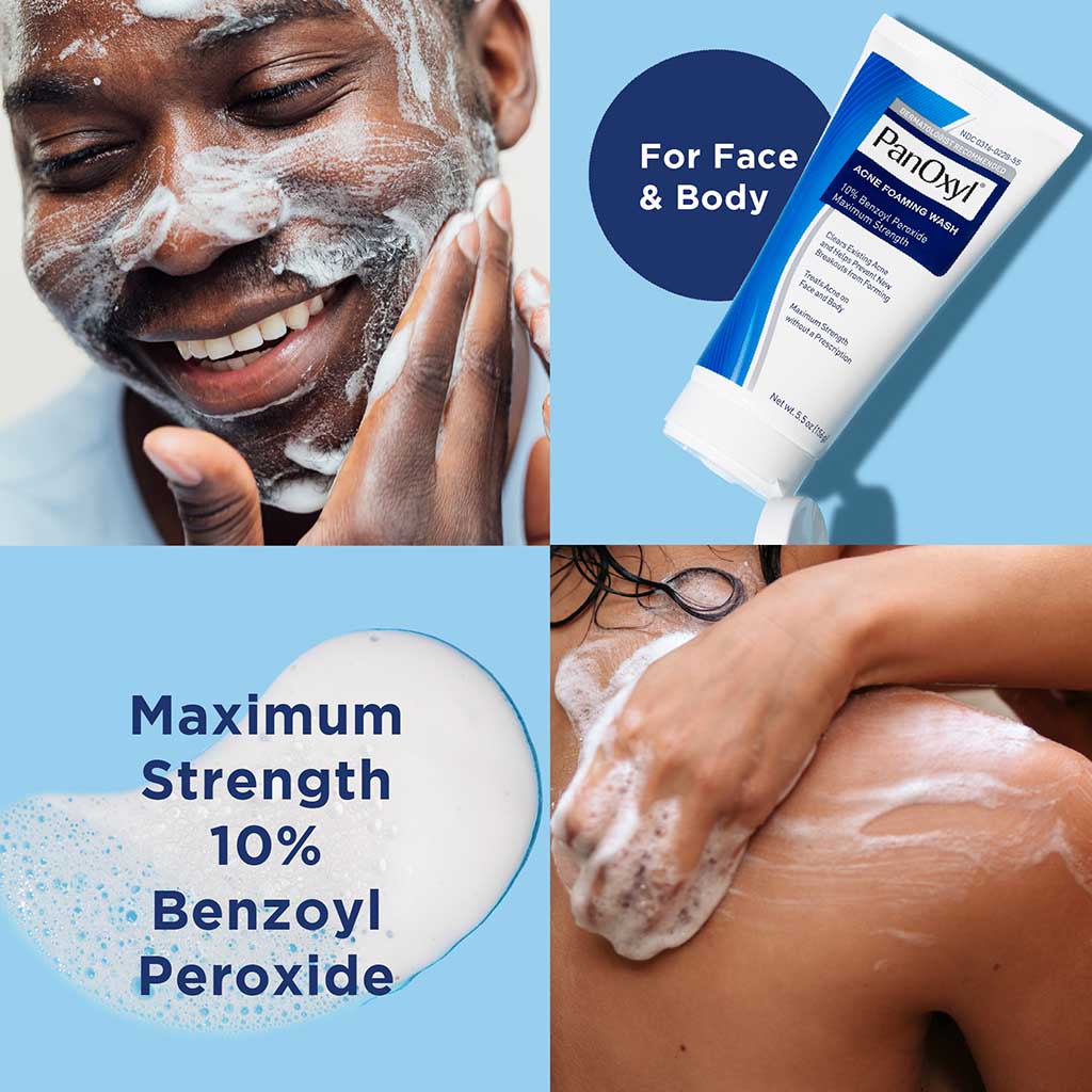 PanOxyl Acne Foaming Face & Body Wash With 10% Benzoyl Peroxide 156g 