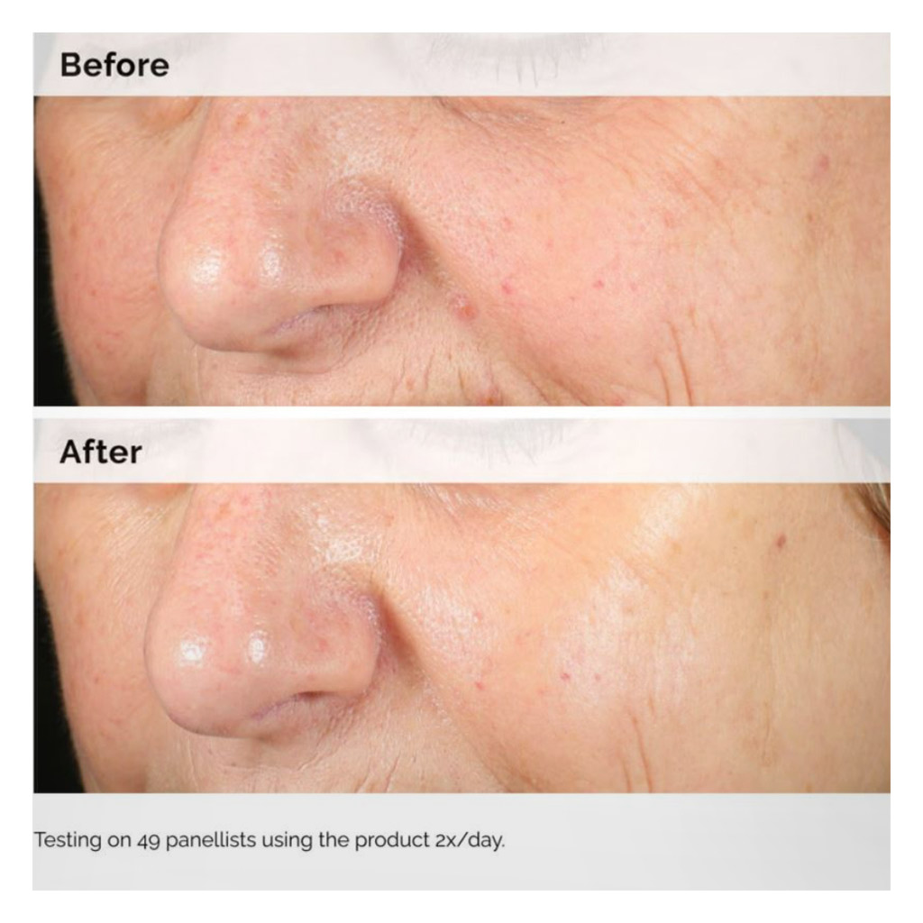 The Ordinary Alpha Arbutin 2% & Hyaluronic Acid Water Based Face Serum For Uneven Skin Tone 30ml