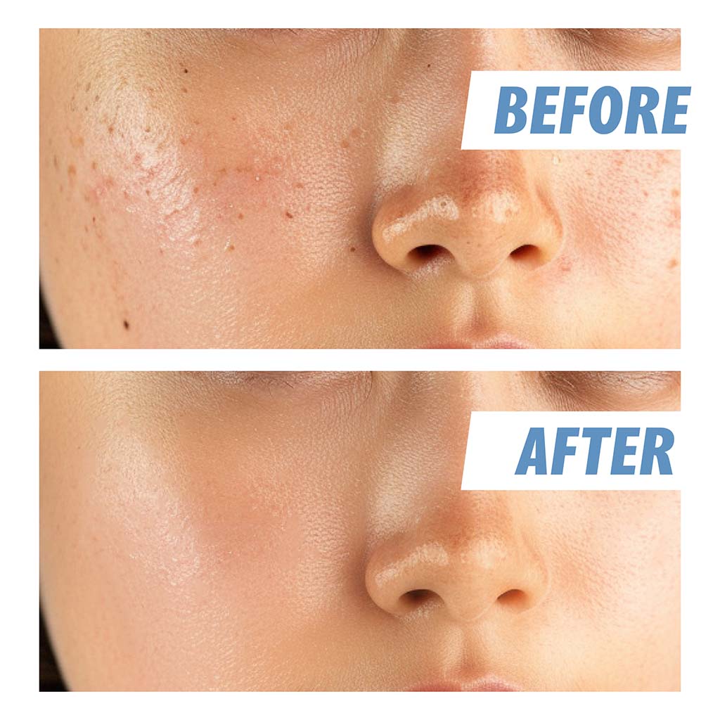 Nightingale Daily Derma Facial Cleansing Foam For Sensitive Skin 140ml