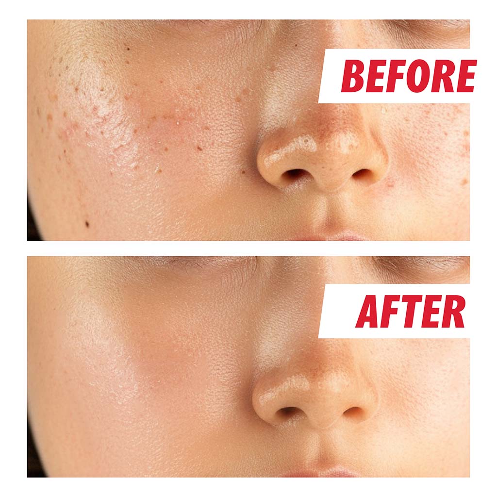 Nightingale Daily Derma Deep Facial Cleansing Pads For All Skin Types 270ml, Pack of 70’s