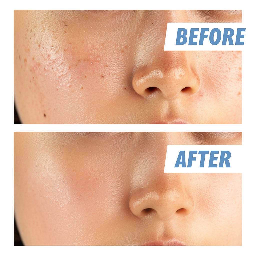 Nightingale Daily Derma Facial Cleansing Pads For Sensitive Skin 270ml, Pack of 70’s