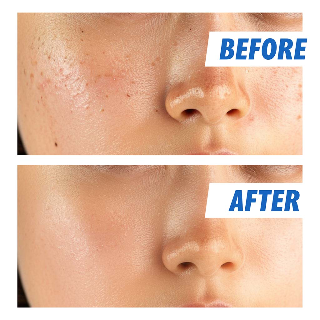 Nightingale Ecto Hyaluronic Moisturizing & Soothing Facial Ampoule Serum For All Skin Types 50ml 