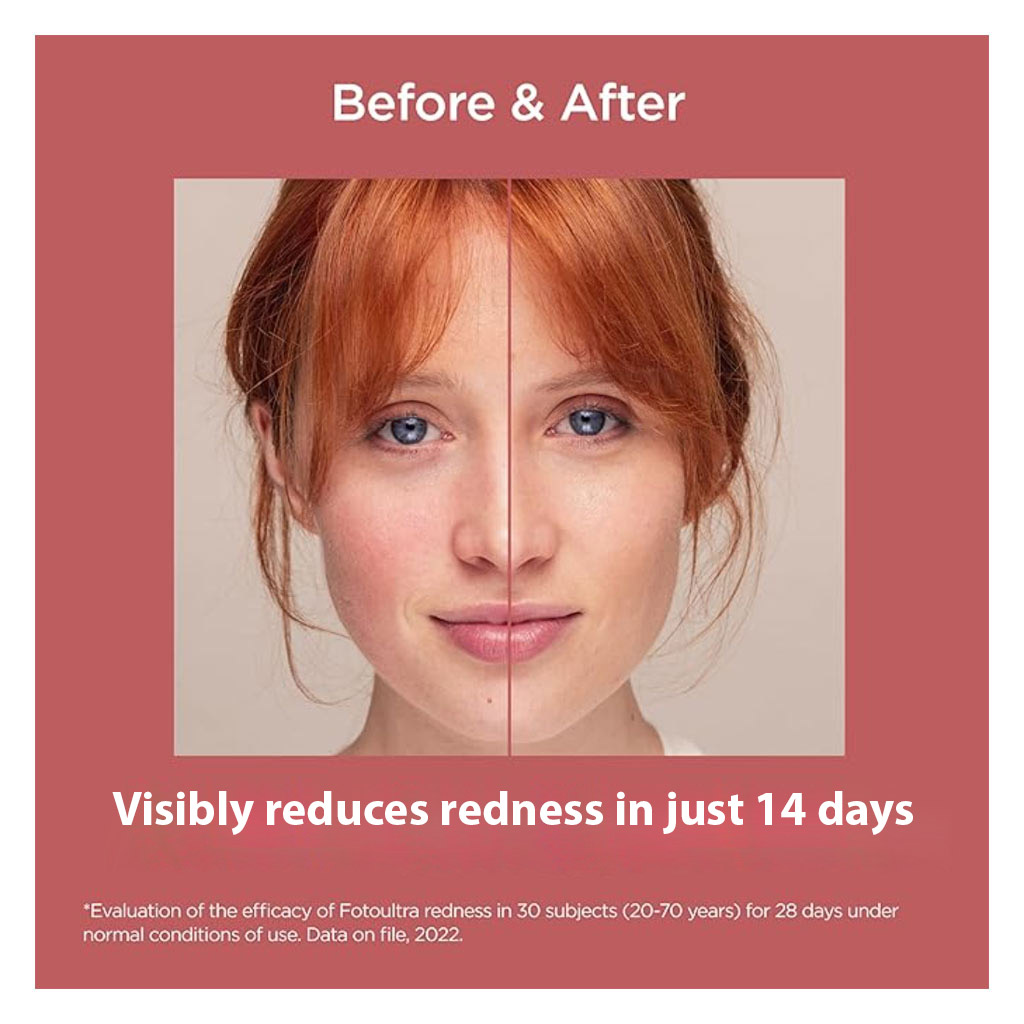 Isdin Fotoultra Redness SPF50 & PA++++ Sunscreen For Sensitive Skin 50ml