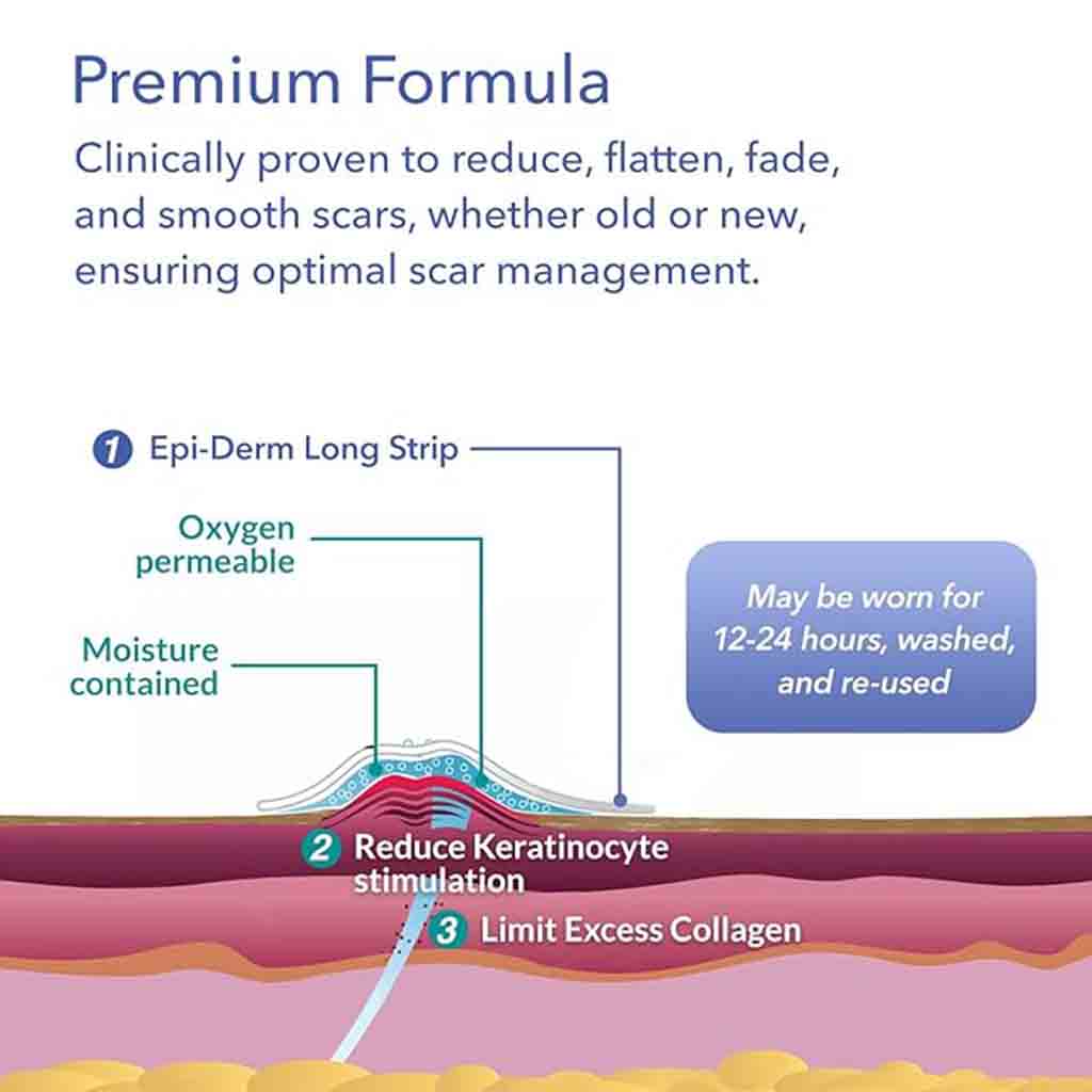 Biodermis EpiDerm Long Strip Natural Silicone Gel Sheeting For Scars, Size 3.6 *29cm - 1 Pair