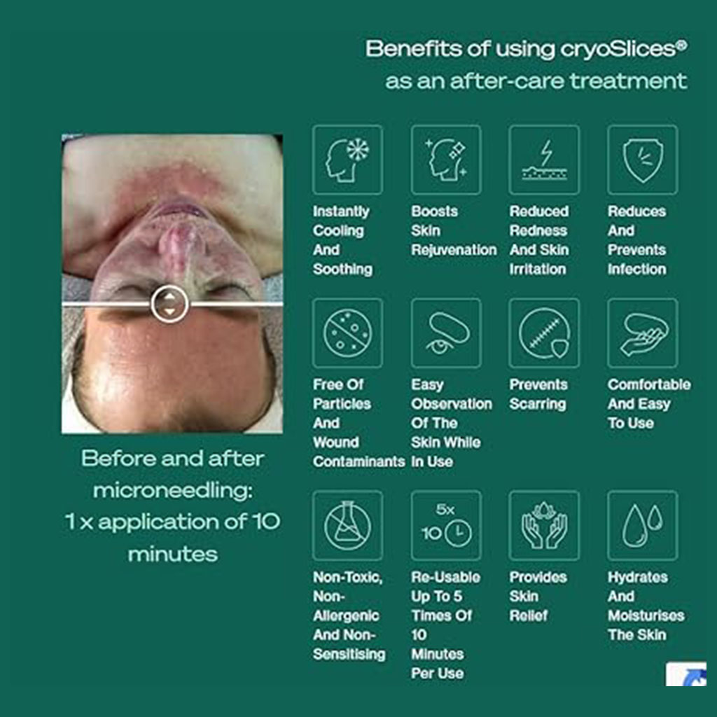 Cryoslices Aftercare Skin Restoration Gel - 4 Piece Multiuse Face Mask 