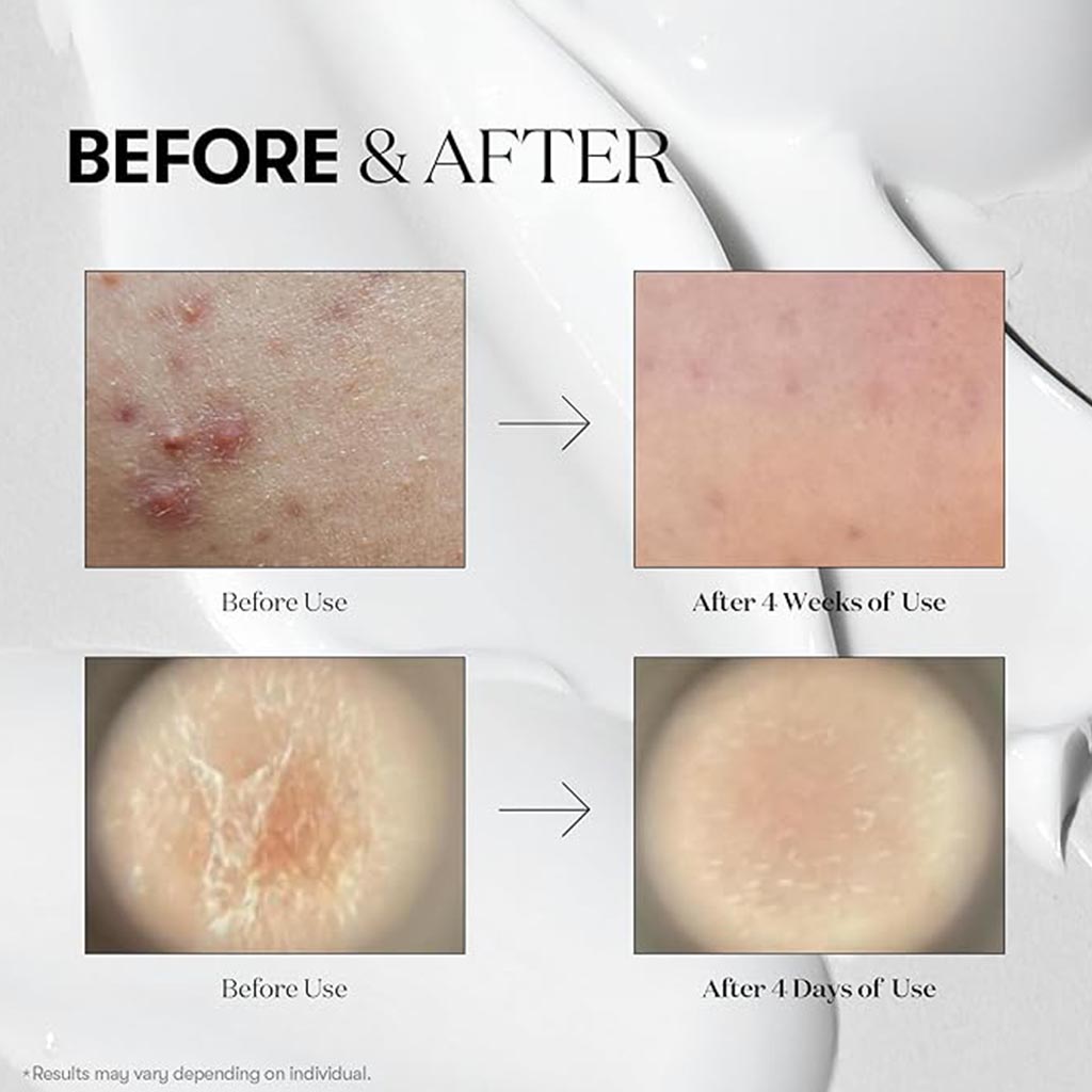 VT Cosmetics Cica Mild Hyalon Reedle 50 Shot All Day Starter Face Serum 50ml