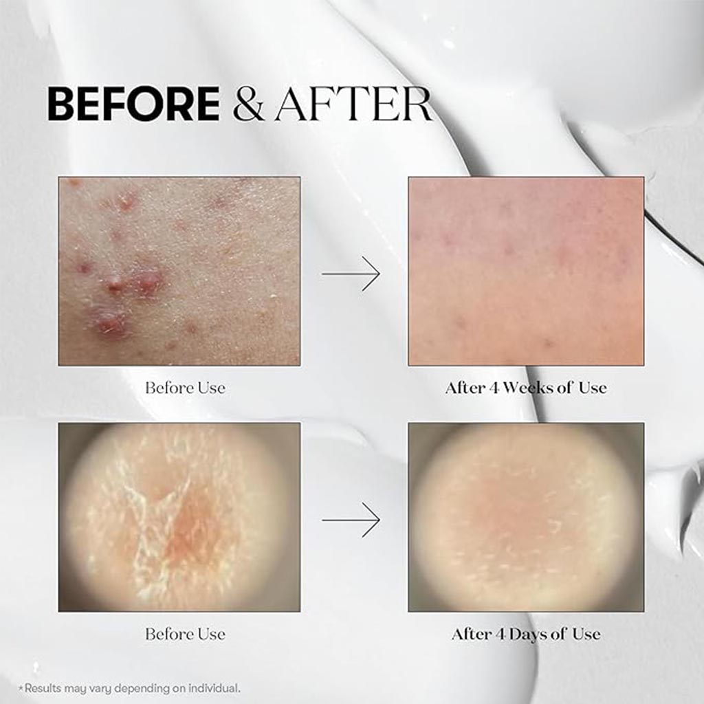 VT Cosmetics Cica Hyalon 100 Reedle Shot Face Serum 50ml