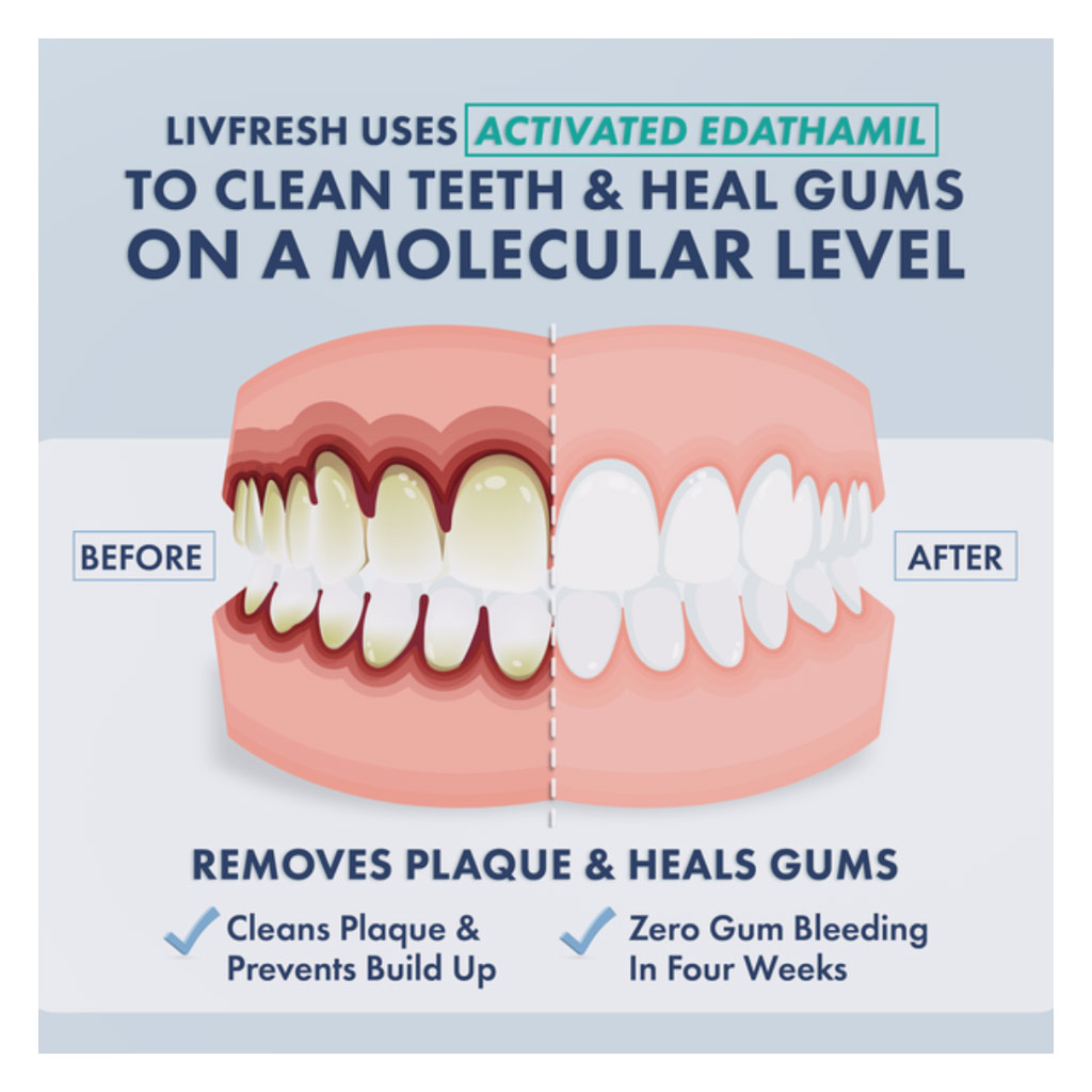 Livfresh Mild Peppermint Whitening Non-Foaming Gel Toothpaste 50g