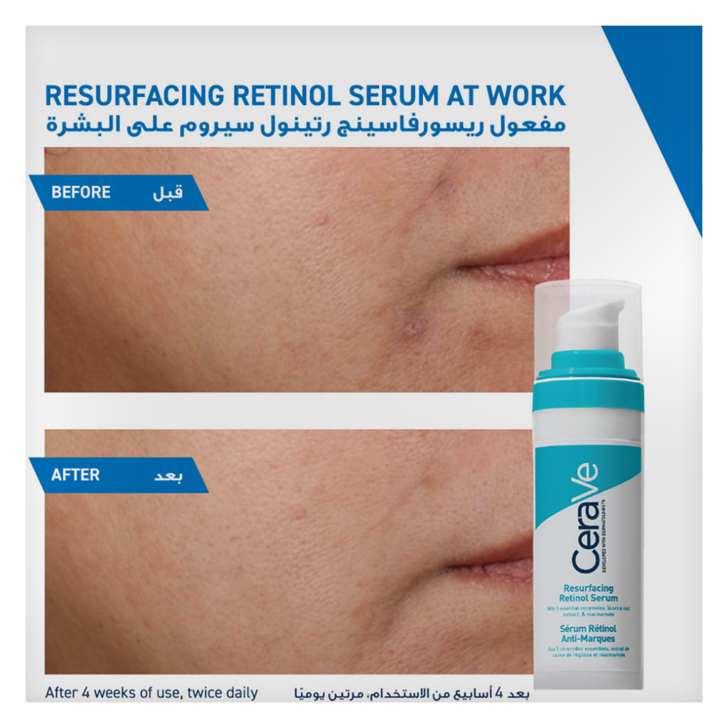 CeraVe Resurfacing Retinol Face Serum 30ml