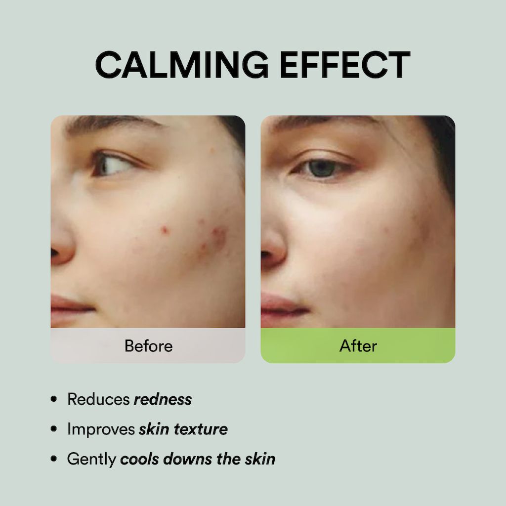 Abib Heartleaf Spot Pad Calming Touch, Pack of 80's